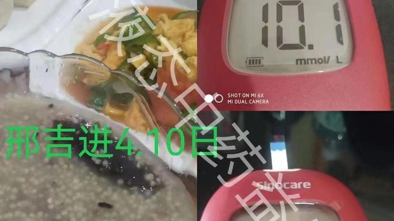 碳酸钙与柠檬酸钙：维生素D3补充剂的"双生兄弟